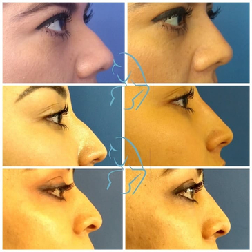 Slider image (4) Dr. Xavier Toscano - Plastic Surgeon